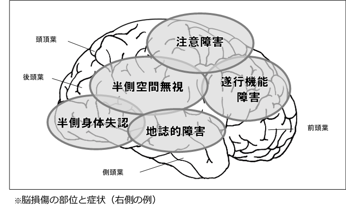 障害 症状 機能 高 次 脳